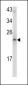 MCT-1 Antibody (N-term)